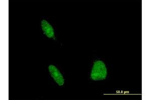Immunofluorescence of monoclonal antibody to ERCC1 on HeLa cell. (ERCC1 抗体  (AA 207-281))