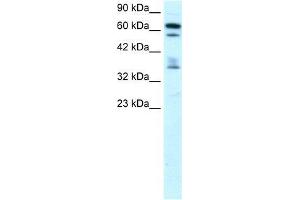 Human Brain; WB Suggested Anti-ZNF512 Antibody Titration: 0. (ZNF512 抗体  (Middle Region))