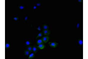 Immunofluorescent analysis of A431 cells using ABIN7173806 at dilution of 1:100 and Alexa Fluor 488-congugated AffiniPure Goat Anti-Rabbit IgG(H+L) (TNFSF14 抗体  (AA 1-239))