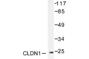 Image no. 1 for anti-Claudin 1 (CLDN1) antibody (ABIN265358) (Claudin 1 抗体)