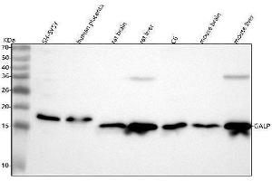Western blot analysis of GALP using anti-GALP antibody (ABIN7598960).