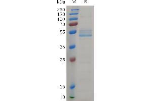 SDS-PAGE (SDS) image for Midkine (Neurite Growth-Promoting Factor 2) (MDK) (AA 23-143) protein (Fc Tag) (ABIN7490815)