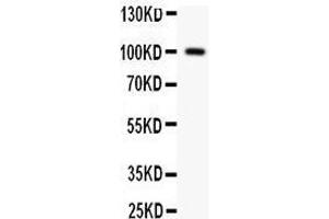 anti-Prothrombin Fragment 2 (C-Term) antibody
