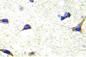 Immunohistochemistry (IHC) analyzes of LIMK1/2 antibody in paraffin-embedded human brain tissue. (LIM Domain Kinase 1 抗体)