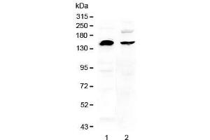 Western blot testing of human 1) U-87 MG and 2) MDA-MB-453 cell lysate with NEDD4 antibody at 0. (NEDD4 抗体)
