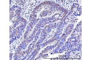 IHC analysis of RBM15B using anti-RBM15B antibody (ABIN7600219). (RBM15B 抗体  (AA 164-890))