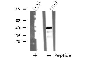 Western blot analysis of extracts from COS7 cells, using TSSC1 antibody. (TSSC1 抗体)