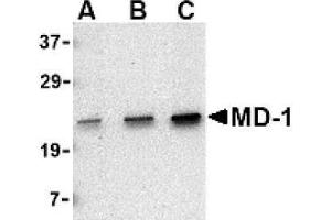 Image no. 1 for anti-Lymphocyte Antigen 86 (LY86) (C-Term) antibody (ABIN265131) (LY86 抗体  (C-Term))