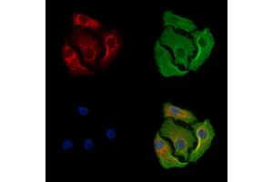 MARK3 Antibody staining Hela cells by IF/ICC. (MARK3 抗体)
