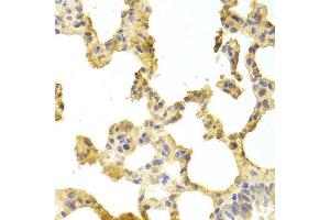 Immunohistochemistry (IHC) image for anti-TNF Receptor-Associated Factor 2 (TRAF2) (AA 1-300) antibody (ABIN3021165) (TRAF2 抗体  (AA 1-300))
