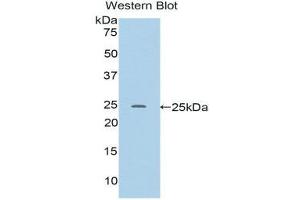 Western Blotting (WB) image for anti-RalA Binding Protein 1 (RALBP1) (AA 192-380) antibody (ABIN1176607) (RALBP1 抗体  (AA 192-380))