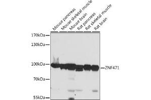 Western blot analysis of extracts of various cell lines, using ZNF471 antibody (ABIN7271491) at 1:1000 dilution. (ZNF471 抗体  (AA 80-210))