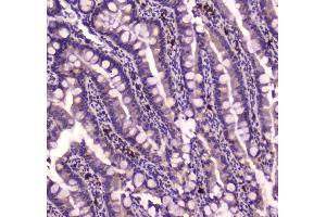 IHC analysis of IGF2R using anti-IGF2R antibody .