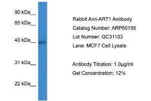 WB Suggested Anti-ART1  Antibody Titration: 0. (ART1 抗体  (C-Term))