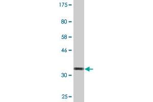 Western Blot detection against Immunogen (36. (OMP 抗体  (AA 65-163))