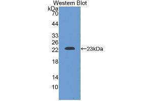 Detection of Recombinant CRYbB2, Rat using Polyclonal Antibody to Crystallin Beta B2 (CRYbB2) (CRYbB2 抗体  (AA 17-191))