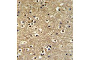 Formalin fixed and paraffin embedded brain tissue reacted with ETS2 Antibody (Center) followed by peroxidase conjugation of the secondary antibody and DAB staining.
