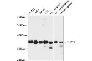 Western blot analysis of extracts of various cell lines, using NUP35 antibody (ABIN6129527, ABIN6144960, ABIN6144961 and ABIN6216505) at 1:3000 dilution. (NUP35 抗体  (AA 1-326))