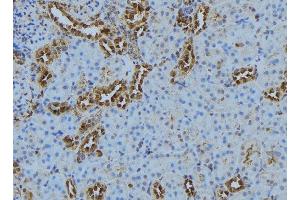 ABIN6278096 at 1/100 staining Mouse kidney tissue by IHC-P. (CASQ2 抗体)