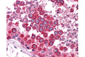 Anti-WNT2B antibody IHC of human testis.