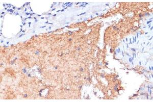 Immunohistochemistry of paraffin-embedded Mouse lung using APOA1 Polyclonal Antibody at dilution of 1:100 (40x lens). (APOA1 抗体)