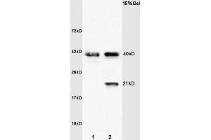 L1 rat brain lysates L2 human colon carcinoma lysates probed with Anti- Syndecan 4 Polyclonal Antibody, Unconjugated (ABIN681793) at 1:200 overnight at 4 °C. (SDC4 抗体  (AA 101-198))