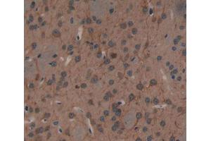 Immunohistochemistry (IHC) image for anti-Protocadherin alpha 1 (PCDHA1) (AA 31-243) antibody (ABIN5014231)