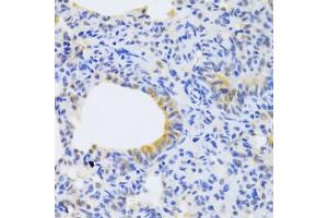 Immunohistochemistry of paraffin-embedded rat lung using MRPS30 Antibody (ABIN5973453) at dilution of 1/100 (40x lens). (MRPS30 抗体)