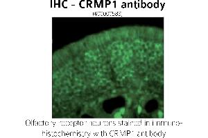 Image no. 1 for anti-GABA Transporter 1 (GAT1) (C-Term) antibody (ABIN346940) (SLC6A1 抗体  (C-Term))