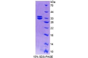 SDS-PAGE analysis of Human MTUS1 Protein. (MTUS1 蛋白)