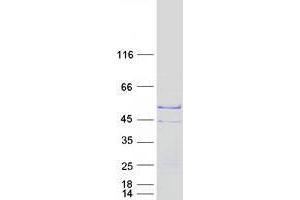 Western Blotting (WB) image for Testis Specific Protein, Y-Linked 2 (TSPY2) protein (Myc-DYKDDDDK Tag) (ABIN2734454)