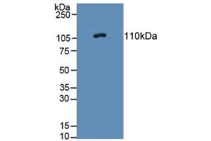 Detection of PTPRN in Rat Adrenal Gland Tissue using Polyclonal Antibody to Protein Tyrosine Phosphatase Receptor Type N (PTPRN) (PTPRN 抗体  (AA 368-575))