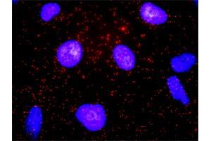 Proximity Ligation Analysis of protein-protein interactions between CD19 and CD82. (CD19 抗体  (AA 1-556))