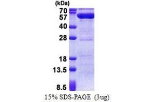 SDS-PAGE (SDS) image for Protein Phosphatase 1F (PP2C Domain Containing) (PPM1F) (AA 1-454) protein (His tag) (ABIN5853181) (PPM1F Protein (AA 1-454) (His tag))