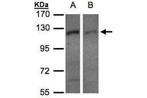 WB Image Sample(30 μg of whole cell lysate) A:H1299 B:HeLa S3, 7. (Exportin 7 抗体  (C-Term))