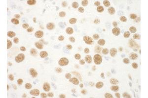 Immunohistochemistry (IHC) image for anti-Nucleophosmin (Nucleolar phosphoprotein B23, Numatrin) (NPM1) (AA 250-294) antibody (ABIN7448992) (NPM1 抗体  (AA 250-294))