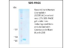 SDS-PAGE (SDS) image for Secretoglobin, Family 1A, Member 1 (Uteroglobin) (SCGB1A1) (Active) protein (ABIN5509511) (SCGB1A1 蛋白)