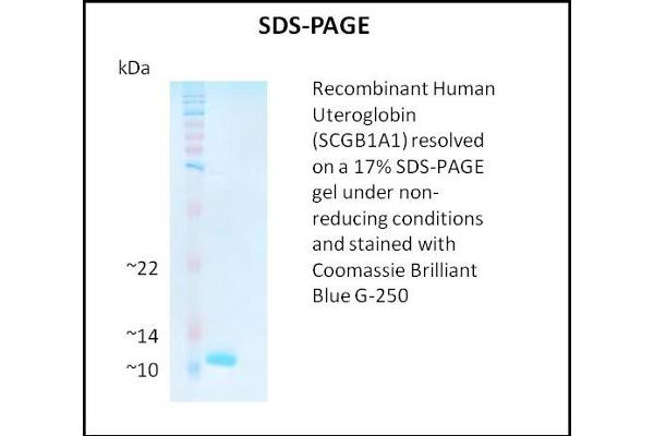 SCGB1A1 蛋白