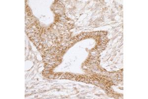 Immunohistochemistry (IHC) image for anti-TNF Receptor-Associated Protein 1 (TRAP1) (AA 50-100) antibody (ABIN7455062) (TRAP1 抗体  (AA 50-100))