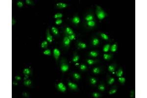 Immunofluorescence staining of Hela cells with ABIN7172427 at 1:200, counter-stained with DAPI. (TCEA3 抗体  (AA 79-169))