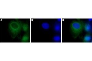 Immunocytochemistry (ICC) image for anti-Transient Receptor Potential Cation Channel, Subfamily C, Member 3 (TRPC3) (AA 822-835), (Intracellular) antibody (ABIN7043820)