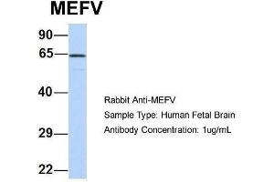 Host:  Rabbit  Target Name:  MEFV  Sample Type:  Human Fetal Brain  Antibody Dilution:  1. (MEFV 抗体  (N-Term))