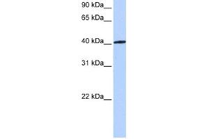 WB Suggested Anti-NR1H3 Antibody Titration:  0. (NR1H3 抗体  (C-Term))