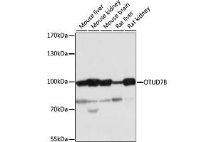Western blot analysis of extracts of various cell lines, using OTUD7B antibody (ABIN7269125) at 1:1000 dilution. (OTUD7B 抗体  (AA 530-700))