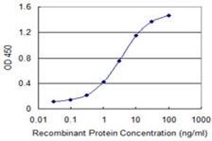 Detection limit for recombinant GST tagged RCBTB1 is 0.