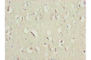 Immunohistochemistry of paraffin-embedded human brain tissue using ABIN7146448 at dilution of 1:100 (CAMK2D 抗体  (AA 1-260))