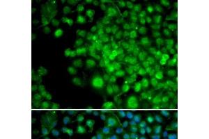 Immunofluorescence analysis of HeLa cells using FHL1 Polyclonal Antibody