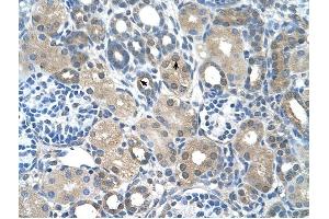 FBXO25 antibody was used for immunohistochemistry at a concentration of 4-8 ug/ml to stain Epithelial cells of renal tubule (arrows) in Human Kidney. (FBXO25 抗体  (C-Term))