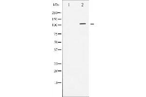 Western blot analysis of Androgen Receptor expression in LOVO whole cell lysates,The lane on the left is treated with the antigen-specific peptide. (Androgen Receptor 抗体)