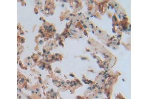 IHC-P analysis of Human Tissue, with DAB staining. (RGS1 抗体  (AA 1-209))